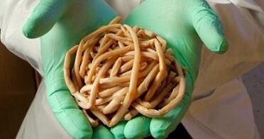 ký sinh trùng được chiết xuất từ ​​​​cơ thể con người
