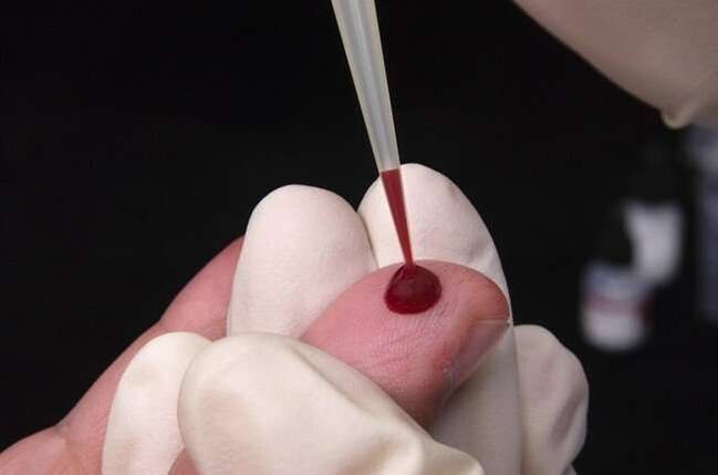lấy máu để phân tích ký sinh trùng