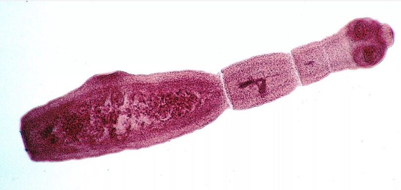 Echinococcus là một trong những ký sinh trùng nguy hiểm nhất đối với con người