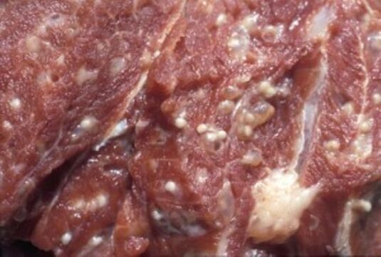 Thịt nhiễm trichinella - loại ký sinh trùng nguy hiểm